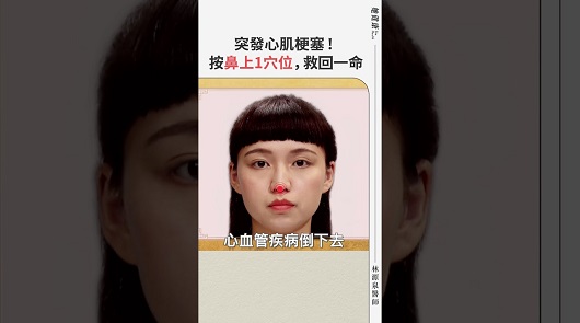 突發心肌梗塞 ？按鼻上1穴位，救回一命